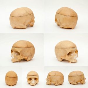 Nacre crâne humain Extérieur